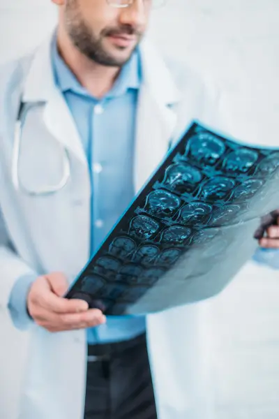 a doctor holding an x-ray