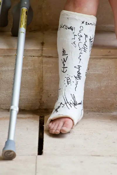 woman with leg in plaster wbp